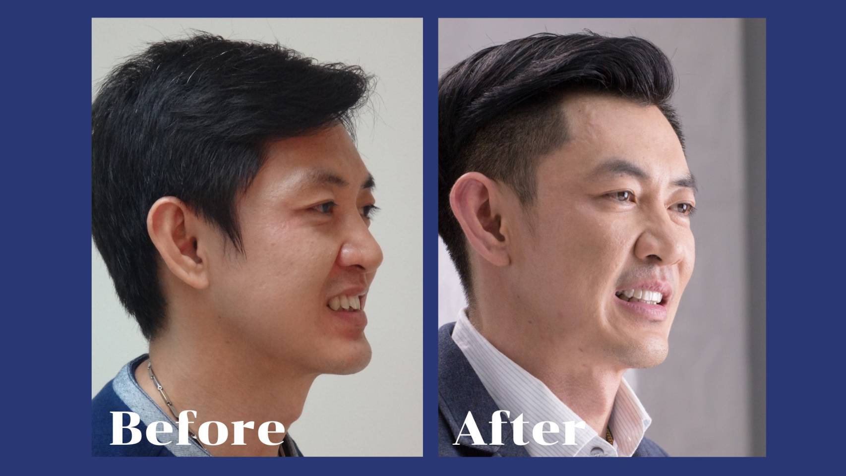 รีวิว จัดฟันแบบใส รศ.ดร.คงธวัช ชัยรัชวิทย์